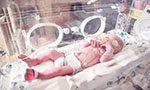 Foto de um bebê deitado na incubadora.